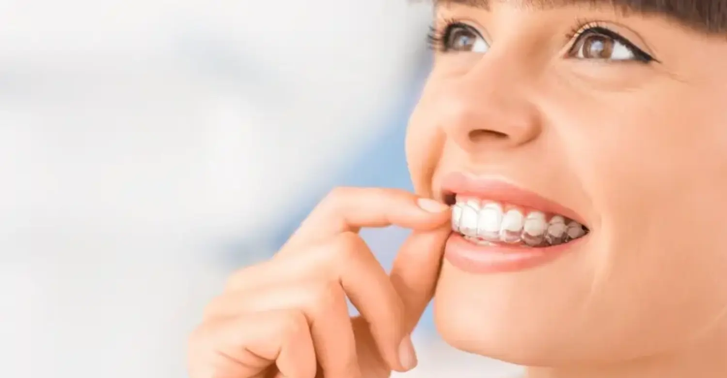 Teeth Straighten Without Braces 2